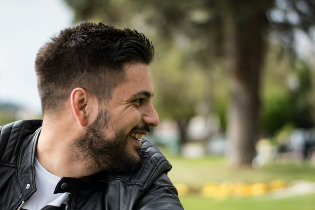 resultado implante capilar chico